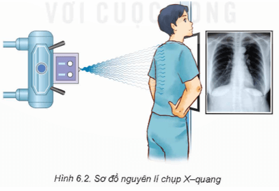 Nêu nguyên lí chụp X-quang trong y học
