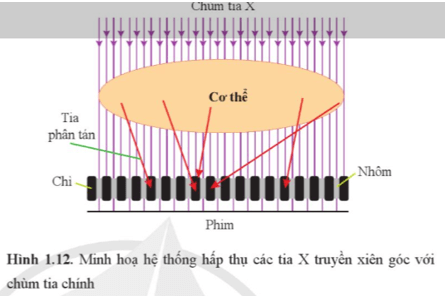 Dựa vào Hình 1.12 giải thích hoạt động của hệ thống làm tăng độ sắc nét của ảnh chụp bằng tia X
