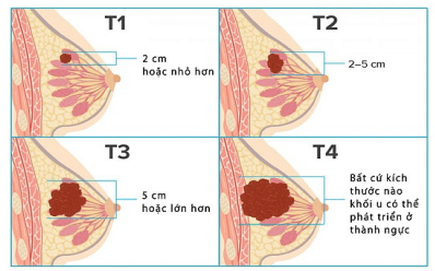 Đề thi Giữa kì 2 Sinh học 10 năm 2024-2025 trường THPT Bố Hạ (Bắc Giang)