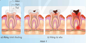 Giáo án Khoa học lớp 5 Kết nối tri thức Bài 20: Vi khuẩn gây bệnh ở người và cách phòng tránh