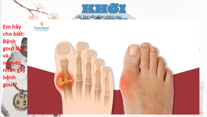 Giáo án điện tử KHTN 8 Kết nối tri thức Bài 36: Điều hòa môi trường trong của cơ thể người | PPT Khoa học tự nhiên 8