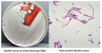 Giáo án Chuyên đề Sinh học 11 Kết nối tri thức Bài 10: Ngộ độc thực phẩm