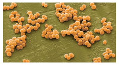 Giáo án Chuyên đề Sinh học 11 Kết nối tri thức Bài 10: Ngộ độc thực phẩm