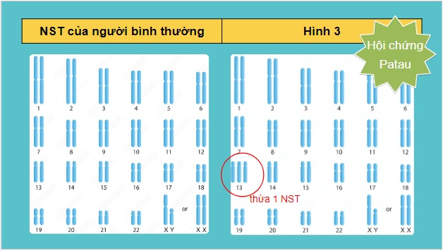 Giáo án điện tử Sinh 12 Cánh diều Bài 6: Đột biến nhiễm sắc thể | PPT Sinh học 12