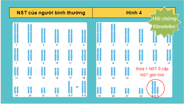 Giáo án điện tử Sinh 12 Cánh diều Bài 6: Đột biến nhiễm sắc thể | PPT Sinh học 12