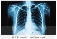 Giáo án Chuyên đề Vật Lí 12 Kết nối tri thức Bài 6: Chụp X-quang. Chụp cắt lớp