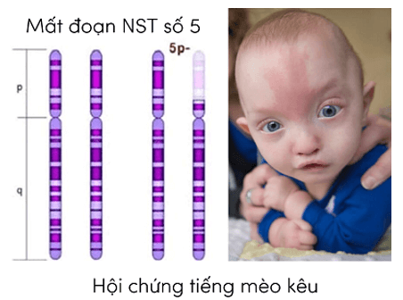 Lý thuyết KHTN 9 Cánh diều Bài 37: Đột biến nhiễm sắc thể