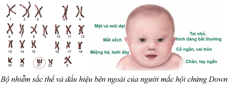 Lý thuyết KHTN 9 Cánh diều Bài 37: Đột biến nhiễm sắc thể
