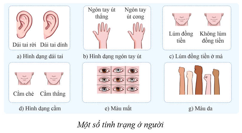 Lý thuyết KHTN 9 Cánh diều Bài 40: Di truyền học người