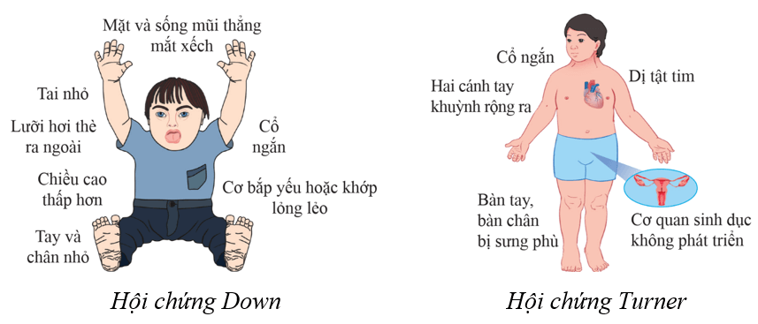 Lý thuyết KHTN 9 Cánh diều Bài 40: Di truyền học người