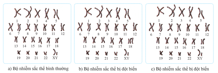 Lý thuyết KHTN 9 Chân trời sáng tạo Bài 41: Cấu trúc nhiễm sắc thể và đột biến nhiễm sắc thể (ảnh 10)