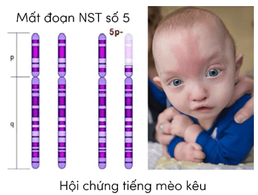 Lý thuyết KHTN 9 Chân trời sáng tạo Bài 41: Cấu trúc nhiễm sắc thể và đột biến nhiễm sắc thể (ảnh 13)