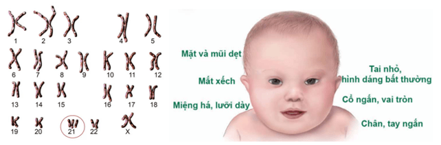 Lý thuyết KHTN 9 Chân trời sáng tạo Bài 41: Cấu trúc nhiễm sắc thể và đột biến nhiễm sắc thể (ảnh 15)