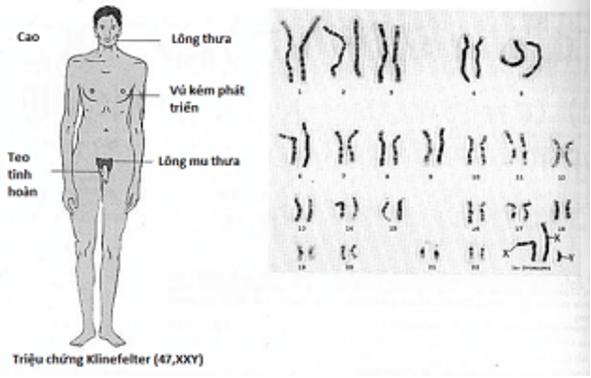 Lý thuyết KHTN 9 Chân trời sáng tạo Bài 41: Cấu trúc nhiễm sắc thể và đột biến nhiễm sắc thể (ảnh 17)