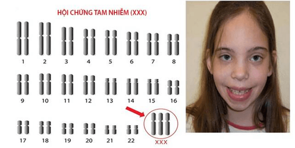 Lý thuyết KHTN 9 Chân trời sáng tạo Bài 41: Cấu trúc nhiễm sắc thể và đột biến nhiễm sắc thể (ảnh 18)