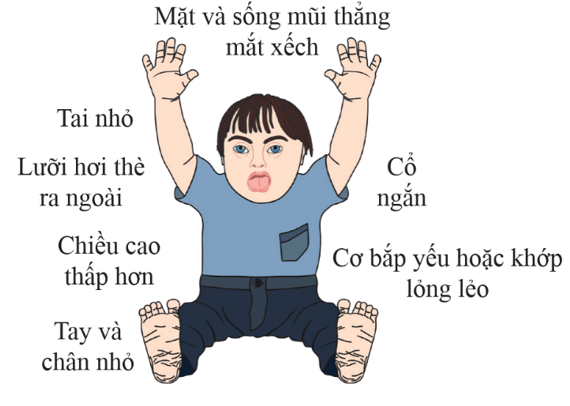 Lý thuyết KHTN 9 Chân trời sáng tạo Bài 44: Di truyền học với con người (ảnh 5)