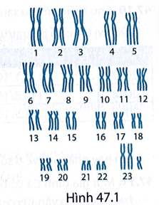 Bộ NST trong Hình 47.1 có thể là bộ NST của người mắc bệnh, tật di truyền nào