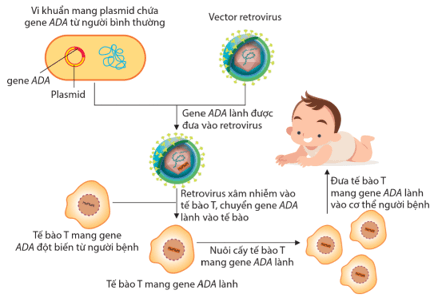 Hình 4.1 mô tả sơ đồ quá trình điều trị rối loạn suy giảm miễn dịch SCID nhờ liệu pháp gene