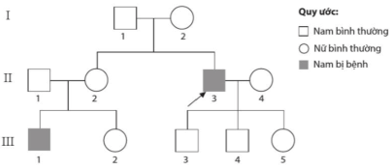 Một bác sĩ khi nghiên cứu bệnh án của một bệnh nhân nam bị đục thủy tinh thể