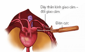 Lý thuyết Sinh 11 Kết nối tri thức Bài 11: Thực hành: Một số thí nghiệm về tuần hoàn