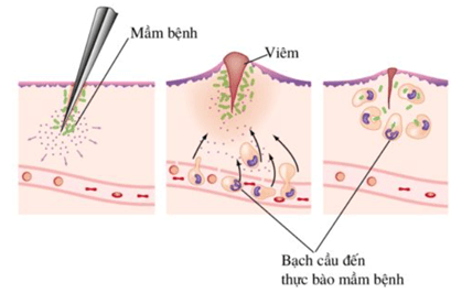 Lý thuyết Sinh 11 Kết nối tri thức Bài 12: Miễn dịch ở người và động vật