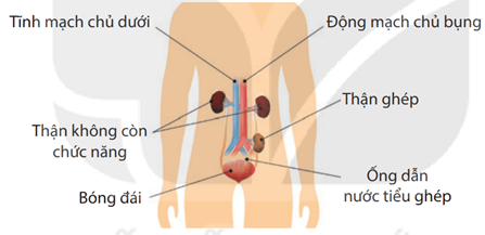 Lý thuyết Sinh 11 Kết nối tri thức Bài 13: Bài tiết và cân bằng nội môi