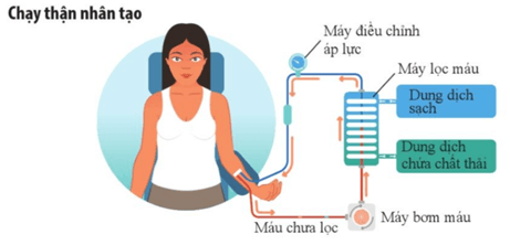Lý thuyết Sinh 11 Kết nối tri thức Bài 13: Bài tiết và cân bằng nội môi
