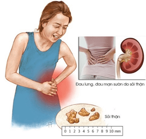 Lý thuyết Sinh 11 Kết nối tri thức Bài 13: Bài tiết và cân bằng nội môi
