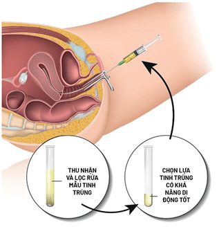 Lý thuyết Sinh 11 Kết nối tri thức Bài 27: Sinh sản ở động vật