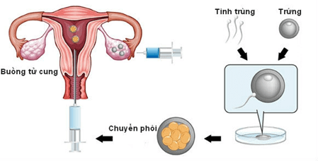 Lý thuyết Sinh 11 Kết nối tri thức Bài 27: Sinh sản ở động vật