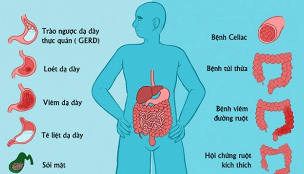 Lý thuyết Sinh 11 Kết nối tri thức Bài 8: Dinh dưỡng và tiêu hóa ở động vật