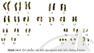 Quan sát hình 14.3 và cho biết biến đổi nào của nhiễm sắc thể gây ra hội chứng Down