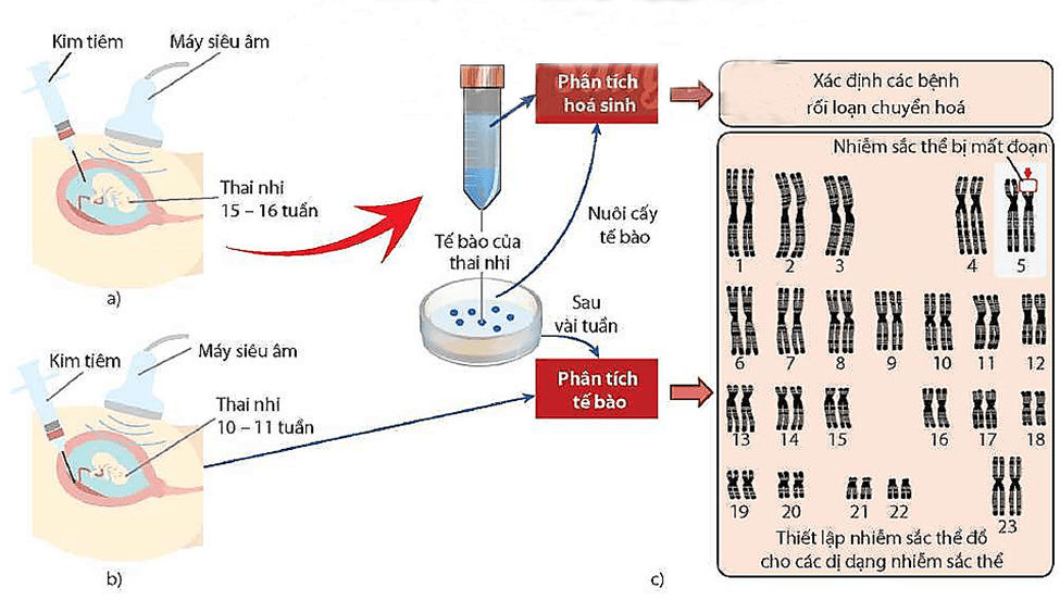 Lý thuyết Di truyền học người (Sinh 12 Cánh diều Bài 14)