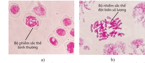 Lý thuyết Đột biến nhiễm sắc thể (Sinh 12 Cánh diều Bài 6)