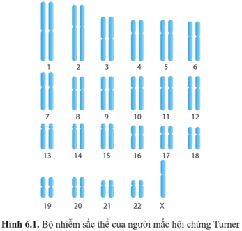 Quan sát hình 6.1 và cho biết bộ nhiễm sắc thể của người mắc hội chứng Turner