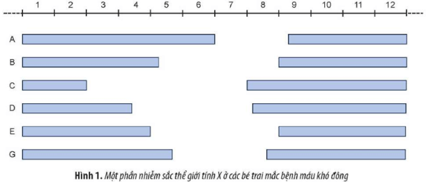 Ở người, bệnh máu khó đông do đột biến gene lặn nằm trên nhiễm sắc thể giới tính X