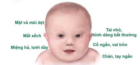 Lý thuyết Sinh 12 Chân trời sáng tạo Bài 5: Nhiễm sắc thể và đột biến nhiễm sắc thể