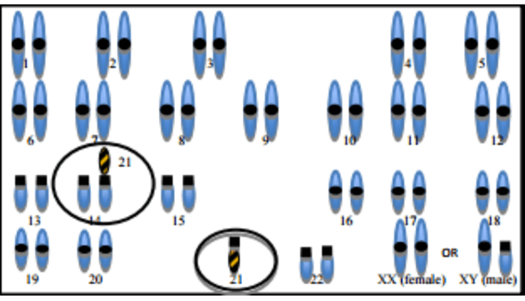 Lý thuyết Đột biến nhiễm sắc thể (Sinh 12 Kết nối tri thức Bài 12)