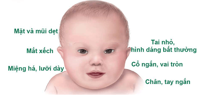 Lý thuyết Di truyền học người và di truyền y học (Sinh 12 Kết nối tri thức Bài 13)