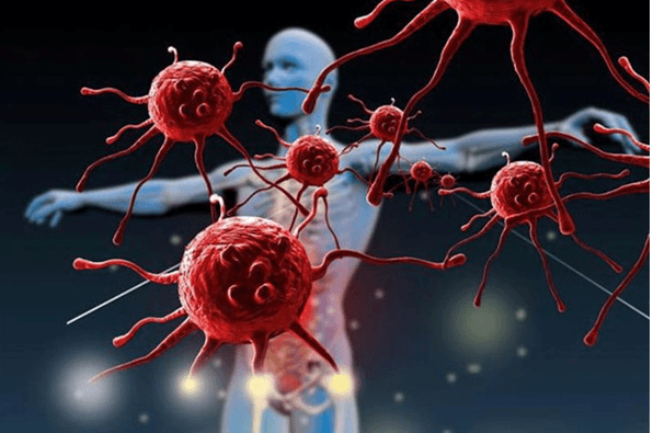 6+ Đoạn văn nghị luận xã hội về căn bệnh ung thư trong thời đại mới (siêu hay)