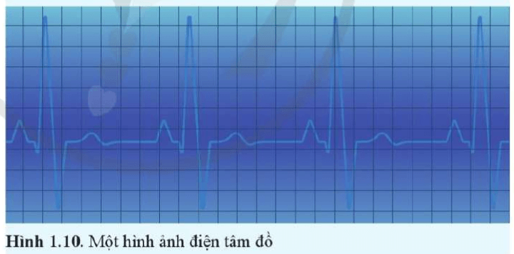 Tim co bóp theo nhịp do được điều khiển bằng một hệ thống các xung điện dẫn truyền trong cơ tim