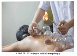 Giác hơi là một kĩ thuật chữa bệnh trong đông y để điều trị các bệnh do 